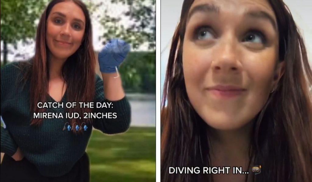 Meet Mikkie Gallagher, TikTok person goes viral for IUD removing video DAILY ZSOCIAL MEDIA NEWS